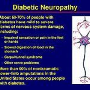 Diabetes Neuropathy