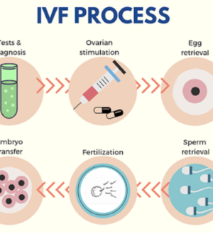 IVF