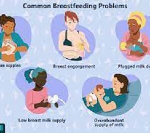 WHAT ARE THE BREASTFEEDING ISSUESWHAT ARE THE BREASTFEEDING ISSUES